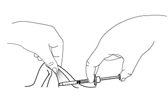 Injection